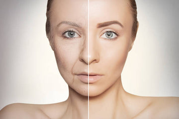 Retinol: A fiatalos és ragyogó bőr titka - VOVA Magyarország