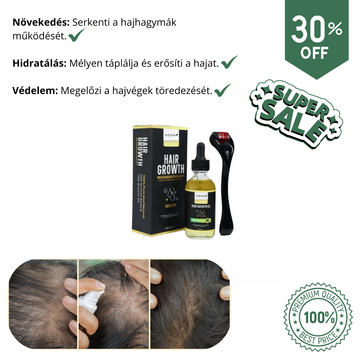 VOVA™ - Hajdúsító szérum & Fejbőrápoló dermaroller
